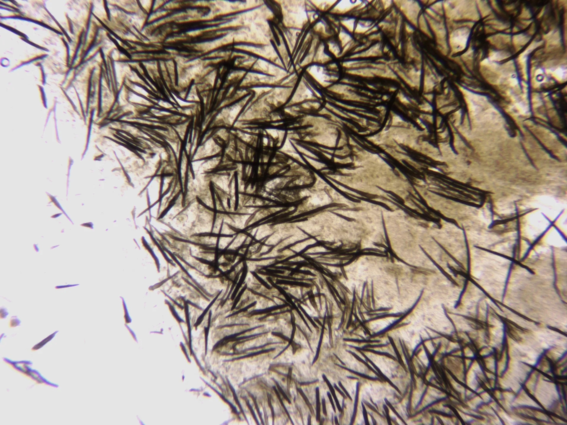 Microscopía de Trichoglossum hirsutum - 10 - Pelos pie agua x 100